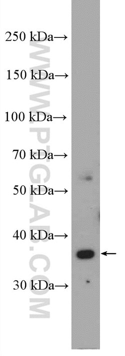 MOS Rabbit Polyclonal Antibody, Proteintech Unconjugated; 20 &mu;L:Antibodies,