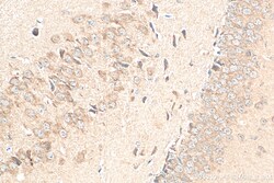MPI Mouse Monoclonal Antibody, Proteintech Unconjugated; 150 &mu;L:Antibodies,