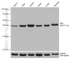 MPI Mouse Monoclonal Antibody, Proteintech Unconjugated; 150 &mu;L:Antibodies,