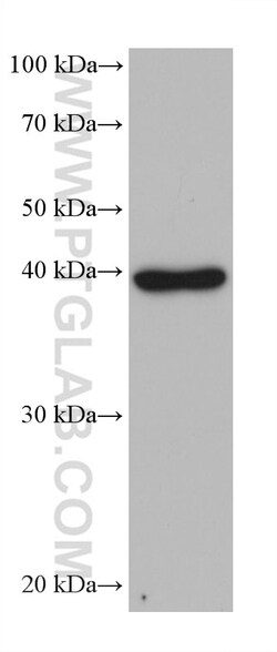 MPI Mouse Monoclonal Antibody, Proteintech Unconjugated; 150 &mu;L:Antibodies,