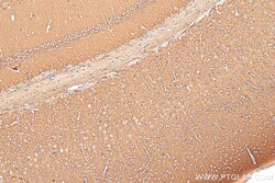 MPP2 Rabbit Polyclonal Antibody, Proteintech Unconjugated; 150 &mu;L:Antibodies,