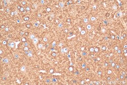 MPP2 Rabbit Polyclonal Antibody, Proteintech Unconjugated; 150 &mu;L:Antibodies,