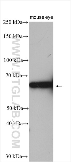 MPP2 Rabbit Polyclonal Antibody, Proteintech Unconjugated; 150 &mu;L:Antibodies,