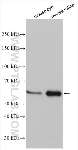 MPP2 Rabbit Polyclonal Antibody, Proteintech Unconjugated; 150 &mu;L:Antibodies,
