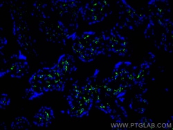 CD206 Rabbit Recombinant Antibody, Proteintech Unconjugated; 20 &mu;L:Antibodies