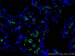 CD206 Rabbit Recombinant Antibody, Proteintech Unconjugated; 20 &mu;L:Antibodies