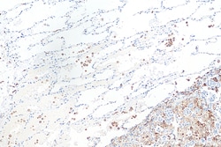 CD206 Rabbit Recombinant Antibody, Proteintech Unconjugated; 20 &mu;L:Antibodies
