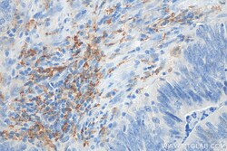 CD206 Rabbit Recombinant Antibody, Proteintech Unconjugated; 20 &mu;L:Antibodies