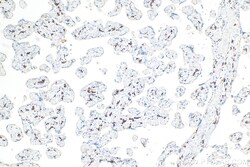 CD206 Rabbit Recombinant Antibody, Proteintech Unconjugated; 20 &mu;L:Antibodies