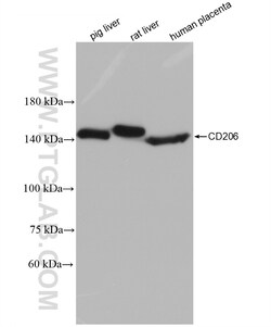 CD206 Rabbit Recombinant Antibody, Proteintech Unconjugated; 20 &mu;L:Antibodies