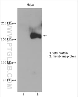 MRP1 Rabbit Polyclonal Antibody, Proteintech Unconjugated; 150 &mu;L:Antibodies,