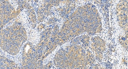 ABCC5 Rabbit Polyclonal Antibody, Proteintech Unconjugated; 20 &mu;L:Antibodies,