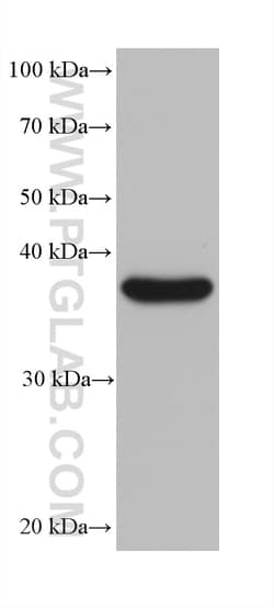 MRPL38 Mouse Monoclonal Antibody, Proteintech Unconjugated; 20 &mu;L:Antibodies,