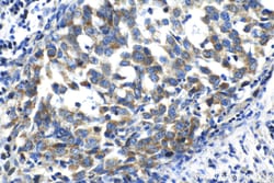 MRPL42 Rabbit Polyclonal Antibody, Proteintech Unconjugated; 150 &mu;L:Antibodies,