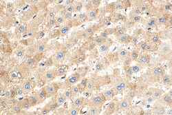 MRPL50 Rabbit Polyclonal Antibody, Proteintech Unconjugated; 20 &mu;L:Antibodies,
