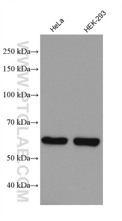 MRPP3 Mouse Monoclonal Antibody, Proteintech Unconjugated; 20 &mu;L:Antibodies,