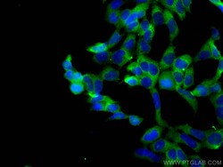 MTHFD1 Mouse Monoclonal Antibody, Proteintech 20 &mu;L | Buy Online | Proteintech | Fisher Scientific