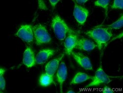 MTHFD1 Mouse Monoclonal Antibody, Proteintech 20 &mu;L | Buy Online | Proteintech | Fisher Scientific