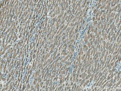 MTHFD1 Mouse Monoclonal Antibody, Proteintech 20 &mu;L | Buy Online | Proteintech | Fisher Scientific