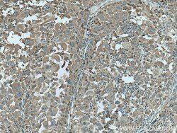 MTHFD1 Mouse Monoclonal Antibody, Proteintech 20 &mu;L | Buy Online | Proteintech | Fisher Scientific