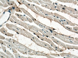 MTMR14 Mouse Monoclonal Antibody, Proteintech Unconjugated; 150 &mu;L:Antibodies,
