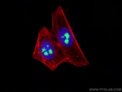 MYBBP1A Mouse Monoclonal Antibody, Proteintech 150 &mu;L | Buy Online | Proteintech | Fisher Scientific