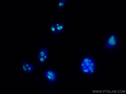 MYBBP1A Mouse Monoclonal Antibody, Proteintech 150 &mu;L | Buy Online | Proteintech | Fisher Scientific