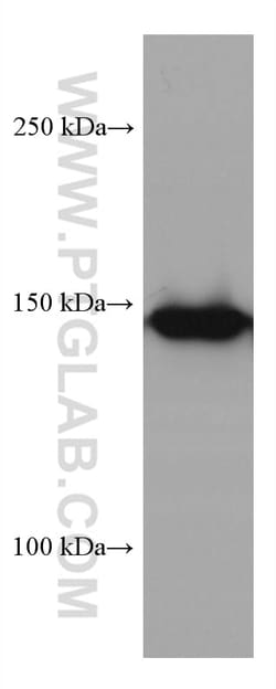 MYBBP1A Mouse Monoclonal Antibody, Proteintech 150 &mu;L | Buy Online | Proteintech | Fisher Scientific