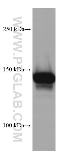 MYBBP1A Mouse Monoclonal Antibody, Proteintech 150 &mu;L | Buy Online | Proteintech | Fisher Scientific