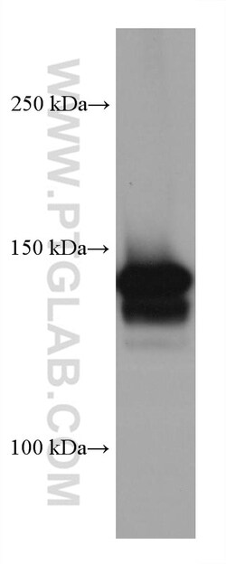 MYBBP1A Mouse Monoclonal Antibody, Proteintech 150 &mu;L | Buy Online | Proteintech | Fisher Scientific