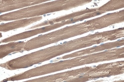 MYH13 Rabbit Polyclonal Antibody, Proteintech Unconjugated; 150 &mu;L:Antibodies,