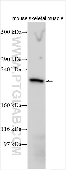 MYH8-Specific Rabbit Polyclonal Antibody, Proteintech Unconjugated; 150