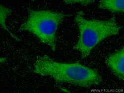 MYL6 Mouse Monoclonal Antibody, Proteintech:Antibodies:Primary Antibodies