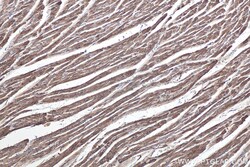 MYL6 Mouse Monoclonal Antibody, Proteintech:Antibodies:Primary Antibodies