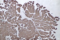 MYL6 Mouse Monoclonal Antibody, Proteintech:Antibodies:Primary Antibodies