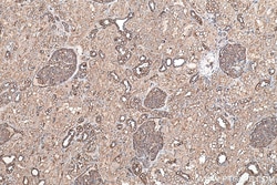 MYL6 Mouse Monoclonal Antibody, Proteintech:Antibodies:Primary Antibodies