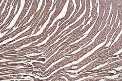 MYL6 Mouse Monoclonal Antibody, Proteintech:Antibodies:Primary Antibodies