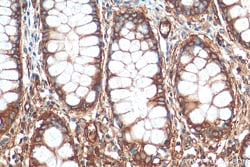 MYL6 Mouse Monoclonal Antibody, Proteintech:Antibodies:Primary Antibodies