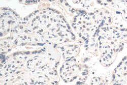 MYNN Rabbit Polyclonal Antibody, Proteintech Unconjugated; 20 &mu;L:Antibodies,
