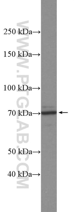 MYNN Rabbit Polyclonal Antibody, Proteintech Unconjugated; 20 &mu;L:Antibodies,