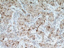 Mammaglobin B Rabbit Polyclonal Antibody, Proteintech Unconjugated; 150