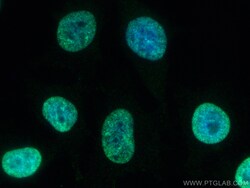 Mono/Di-Methyl-Histone H3 (Lys9) Rabbit Recombinant Antibody, Proteintech:Antibodies:Primary