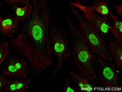 Mono/Di-Methyl-Histone H3 (Lys9) Rabbit Recombinant Antibody, Proteintech:Antibodies:Primary