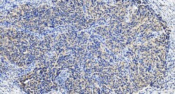 NANP Rabbit Polyclonal Antibody, Proteintech Unconjugated; 20 &mu;L:Antibodies,