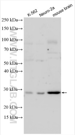 NANP Rabbit Polyclonal Antibody, Proteintech Unconjugated; 20 &mu;L:Antibodies,