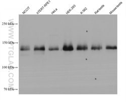 NBR1 Mouse anti-Human, Mouse, Rat, Clone: 1F2B2, Proteintech:Antibodies:Primary
