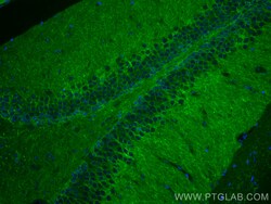 NCAM2 Mouse Monoclonal Antibody, Proteintech:Antibodies:Primary Antibodies