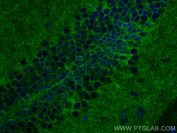 NCAM2 Mouse Monoclonal Antibody, Proteintech:Antibodies:Primary Antibodies
