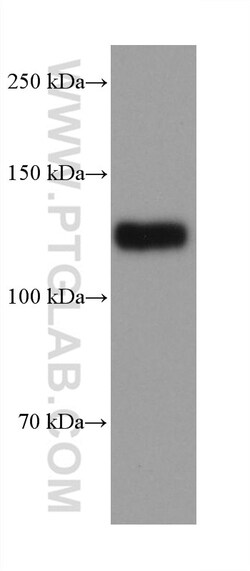 NCAM2 Mouse Monoclonal Antibody, Proteintech:Antibodies:Primary Antibodies