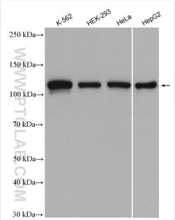 NCAPG Rabbit Polyclonal Antibody, Proteintech Unconjugated; 20 &mu;L:Antibodies,